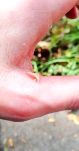 blister